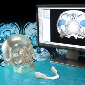3D Customised Implants