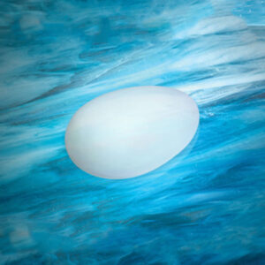 Gluteal Implants