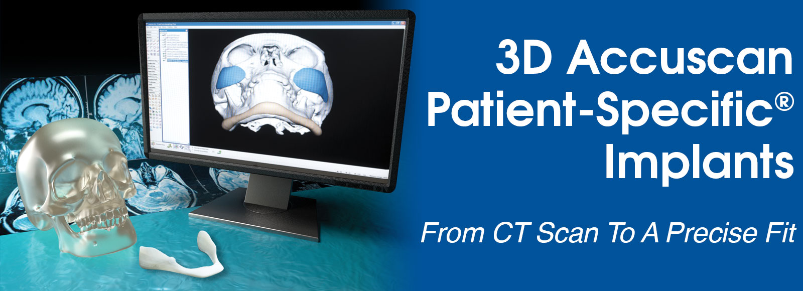 x3DAccuscan_facial_slide